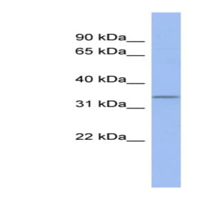 anti-Chromosome 17 Open Reading Frame78 (C17orf78) (Middle Region) antibody avatar