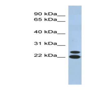 anti-Chromosome 19 Open Reading Frame 54 (C19orf54) (N-Term) antibody avatar