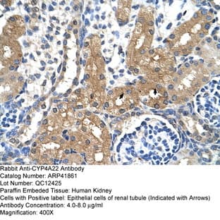 anti-Cytochrome P450, Family 4, Subfamily A, Polypeptide 22 (CYP4A22) (N-Term) antibody avatar