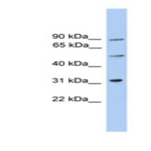 anti-Centrosomal Protein 57kDa-Like 1 (CEP57L1) (Internal Region) antibody avatar