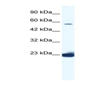 anti-DEAD (Asp-Glu-Ala-Asp) Box Polypeptide 55 (DDX55) (C-Term) antibody