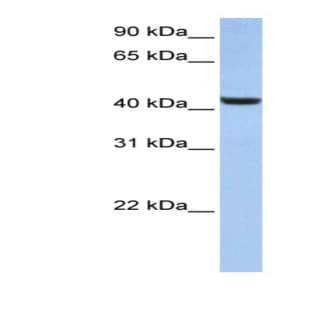 anti-beta-1,3-N-Acetylglucosaminyltransferase 7 (B3GNT7) (N-Term) antibody