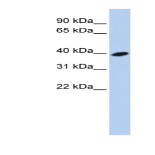 anti-ADP-Ribosylation Factor-Like 13B (ARL13B) (Middle Region) antibody avatar