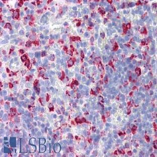 anti-CD68 Molecule (CD68) antibody avatar