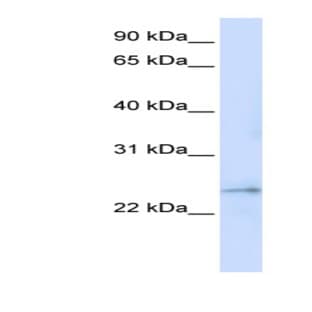 anti-Family with Sequence Similarity 156, Member A (FAM156A) (Middle Region) antibody avatar