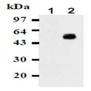 anti-CD274 Molecule (CD274) antibody avatar
