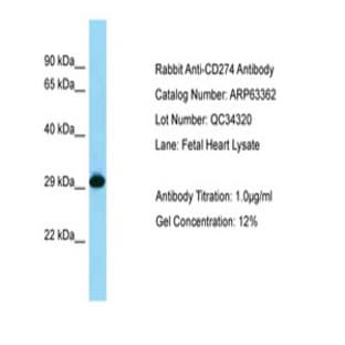 anti-CD274 Molecule (CD274) (C-Term) antibody avatar