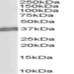 anti-CD274 Molecule (CD274) (C-Term) antibody avatar