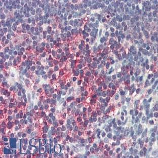 anti-CD274 Molecule (CD274) (Internal Region) antibody avatar