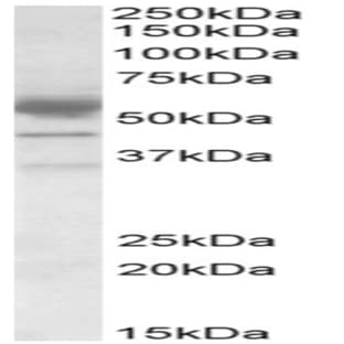 anti-CD274 Molecule (CD274) (C-Term) antibody avatar