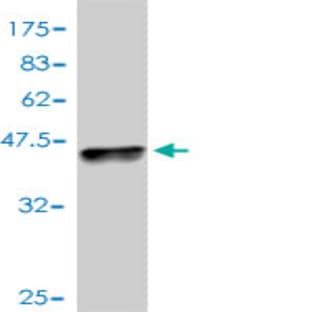 anti-CD274 Molecule (CD274) (AA 141-240) antibody avatar