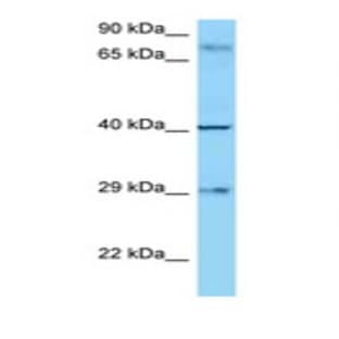 anti-CD274 Molecule (CD274) (C-Term) antibody avatar