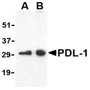 anti-CD274 Molecule (CD274) (N-Term) antibody avatar