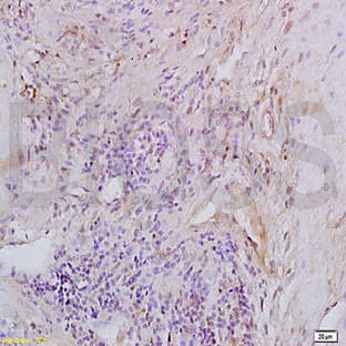 anti-Chemokine (C-X-C Motif) Ligand 2 (CXCL2) antibody avatar