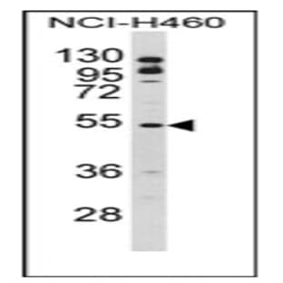 anti-B-Cell Linker (BLNK) (Middle Region) antibody avatar