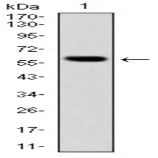 anti-B-Cell Linker (BLNK) antibody avatar
