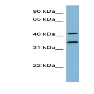 anti-B-Cell Linker (BLNK) (Middle Region) antibody avatar