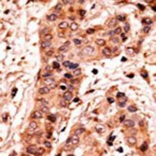anti-Guanylate Cyclase 1, Soluble, alpha 2 (GUCY1A2) (C-Term) antibody avatar