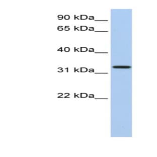 anti-Chromosome 12 Open Reading Frame 24 (C12orf24) (N-Term) antibody avatar