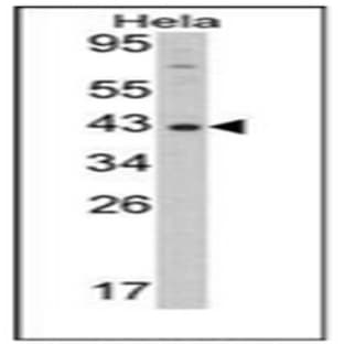 anti-DNA (Cytosine-5-)-Methyltransferase 3 Like (TRDMT1) (AA 392-421) antibody avatar