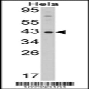 anti-DNA (Cytosine-5-)-Methyltransferase 3 Like (TRDMT1) (AA 389-421) antibody avatar