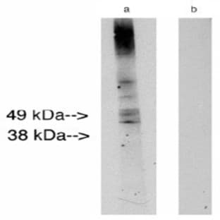 anti-Ceramide Synthase 2 (CERS2) antibody avatar