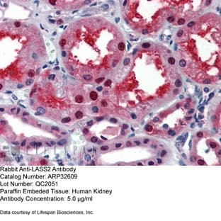 anti-Ceramide Synthase 2 (CERS2) (N-Term) antibody avatar