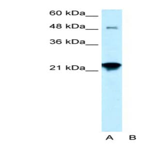 anti-Ceramide Synthase 2 (CERS2) (N-Term) antibody avatar