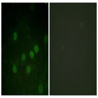 anti-H1 Histone Family, Member 0 (H1F0) (pThr17) antibody avatar