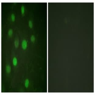 anti-H1 Histone Family, Member 0 (H1F0) antibody avatar
