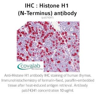 anti-H1 Histone Family, Member 0 (H1F0) (N-Term) antibody avatar
