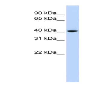 anti-Cyclin D1 (CCND1) (Middle Region) antibody avatar