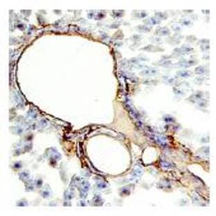anti-CD34 Molecule (CD34) (AA 37-293) antibody avatar