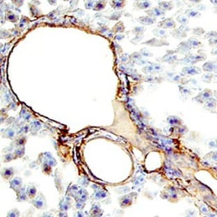 anti-CD34 Molecule (CD34) antibody avatar