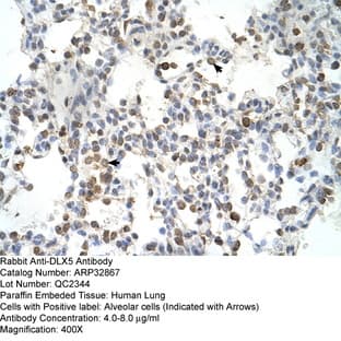 anti-Distal-Less Homeobox 5 (DLX5) (Middle Region) antibody