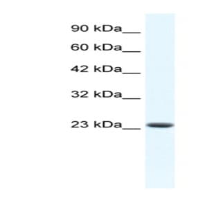 anti-Core-Binding Factor, beta Subunit (CBFB) (N-Term) antibody avatar