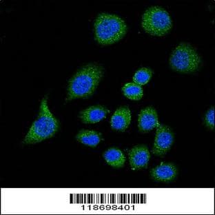 anti-Complement Factor H (CFH) (AA 751-780), (Center) antibody avatar