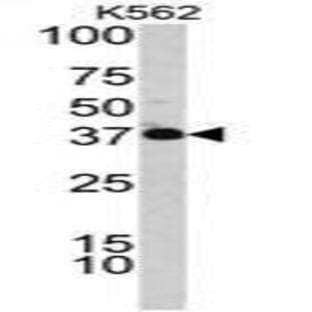 anti-Complement Factor H-Related 1 (CFHR1) (C-Term) antibody avatar