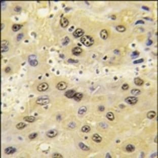 anti-Hypoxia Inducible Factor 1, alpha Subunit (Basic Helix-Loop-Helix Transcription Factor) (HIF1A) (C-Term) antibody avatar