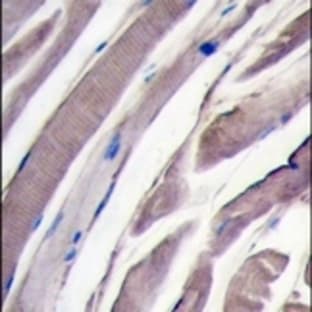 anti-Hexokinase 2 (HK2) (N-Term) antibody avatar
