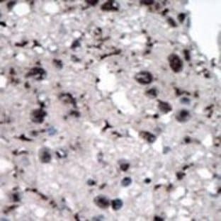 anti-Hexokinase 2 (HK2) (AA 409-438), (Middle Region) antibody avatar