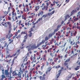 anti-CD163 Molecule (CD163) antibody avatar