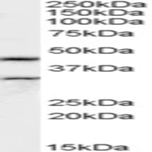 anti-Actin-Like 7b (Actl7b) (Internal Region) antibody avatar