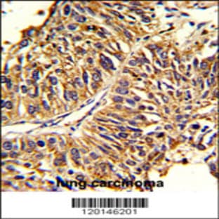anti-3-Hydroxy-3-Methylglutaryl-CoA Synthase 1 (Soluble) (HMGCS1) (AA 290-317), (Center) antibody avatar