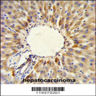 anti-3-Hydroxy-3-Methylglutaryl-CoA Synthase 2 (Mitochondrial) (HMGCS2) (C-Term), (AA 478-508) antibody avatar