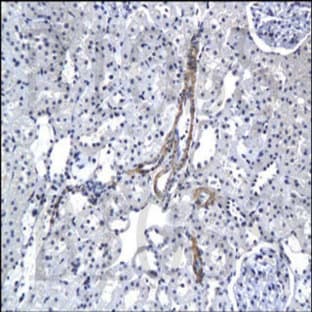 anti-Connective Tissue Growth Factor (CTGF) (Middle Region) antibody avatar