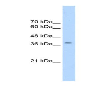 anti-Cyclin-Dependent Kinase 9 (CDK9) (N-Term) antibody avatar