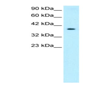 anti-5'-Nucleotidase, Cytosolic III (NT5C3) (Middle Region) antibody avatar