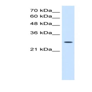 anti-Adenylate Kinase 2 (AK2) (N-Term) antibody avatar