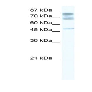 anti-DEAD (Asp-Glu-Ala-Asp) Box Polypeptide 46 (DDX46) (C-Term) antibody avatar